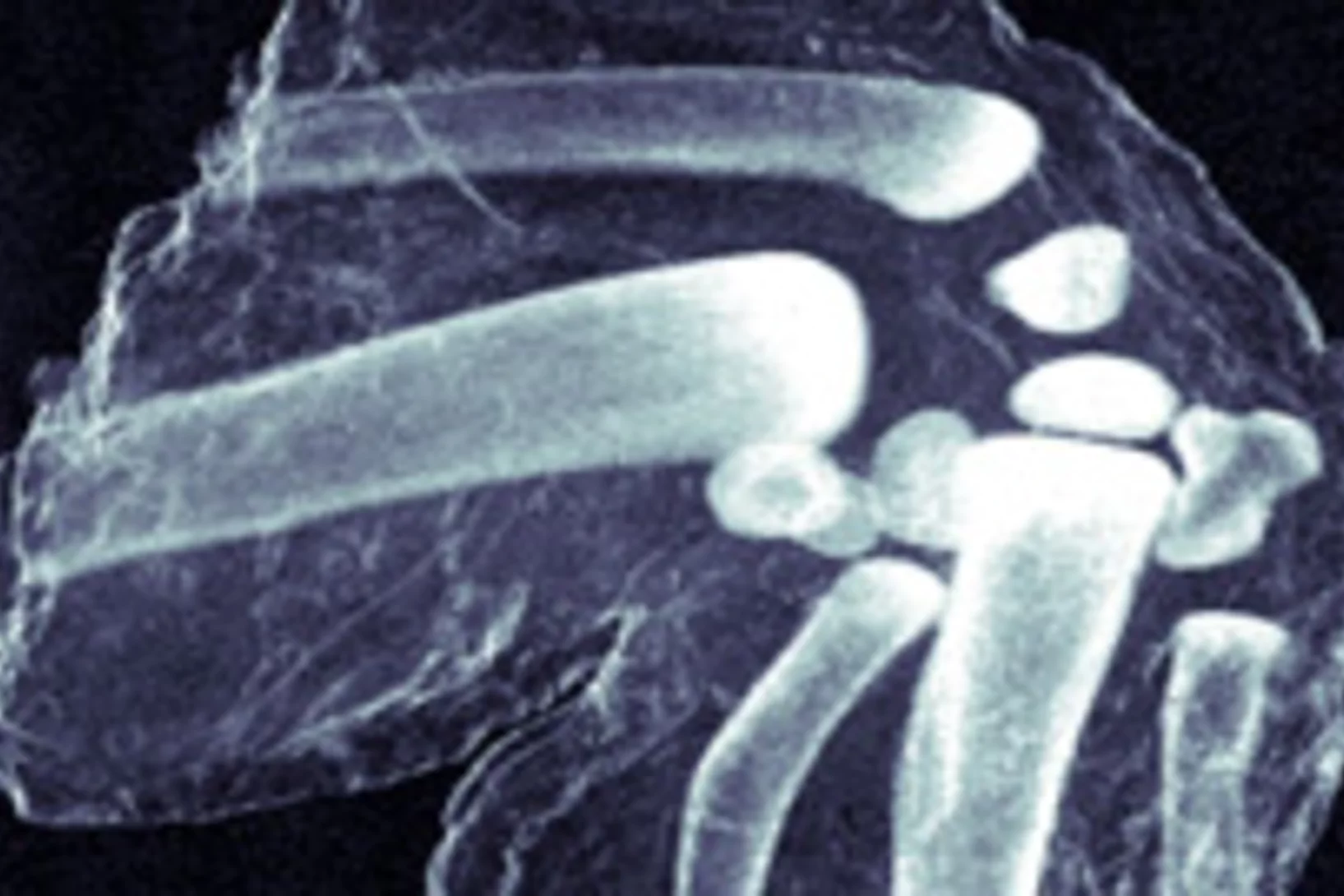 MM080120 xray chickenwing darkfield tn.jpg