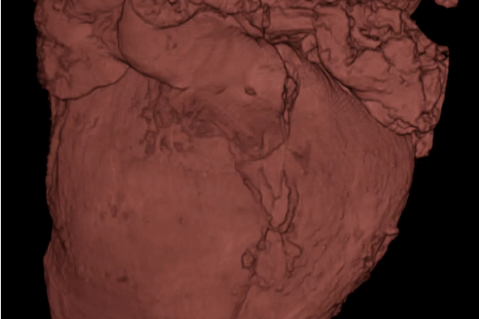 3D rendering of a human fetal heart (15 weeks) acquired with X-ray tomography at 20 keV.