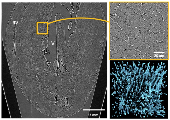 Multiscale image of a cardiac tissue.