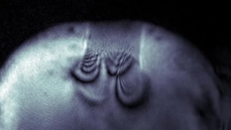 Ptycho-topo teaser image