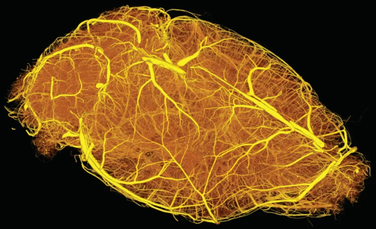 3D reconstruction of an entire adult mouse brain vasculature. 